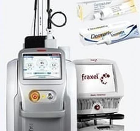 Laser equipment and scar ointments used in scar care