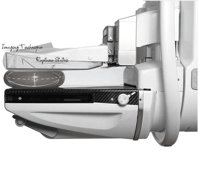 U&U mammography — the breast imaging unit