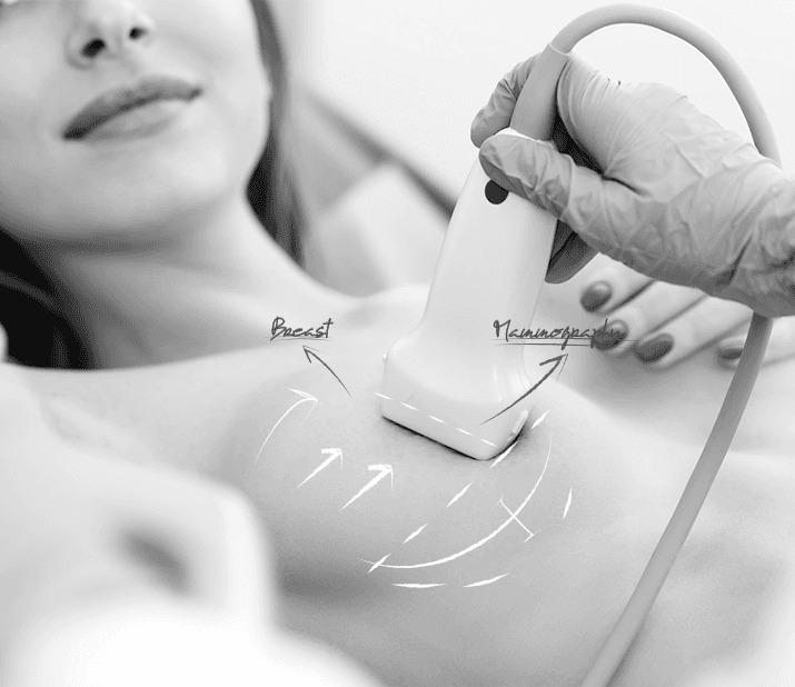 U&U breast cancer ultrasound — examining the breast with an ultrasound probe