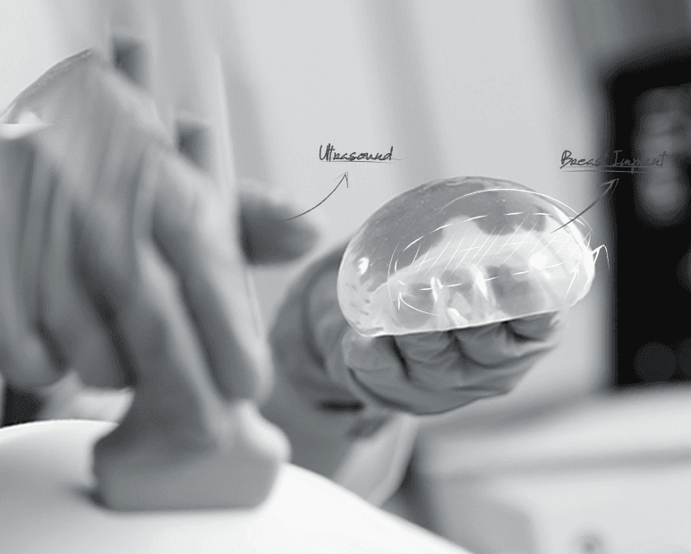 U&U implant ultrasound check-up — reviewing the implant's condition on ultrasound
