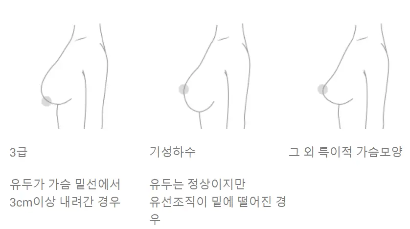Breast Lift Surgery Cost? Why Looking Up the Price First Is Meaningless. — article image 4
