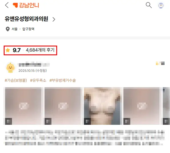 Best breast augmentation clinic in Busan? Pre-consultation tips from a clinic that performed over 3,000 surgeries last year. — article image 4
