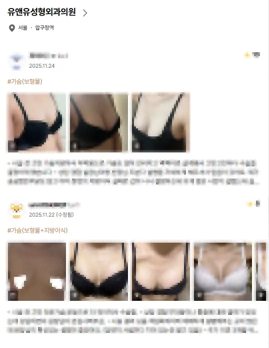 A breast augmentation clinic? 2 things you must know so reviews don't fool you. <Advice drawn from 20 years of research experience> — article image 2