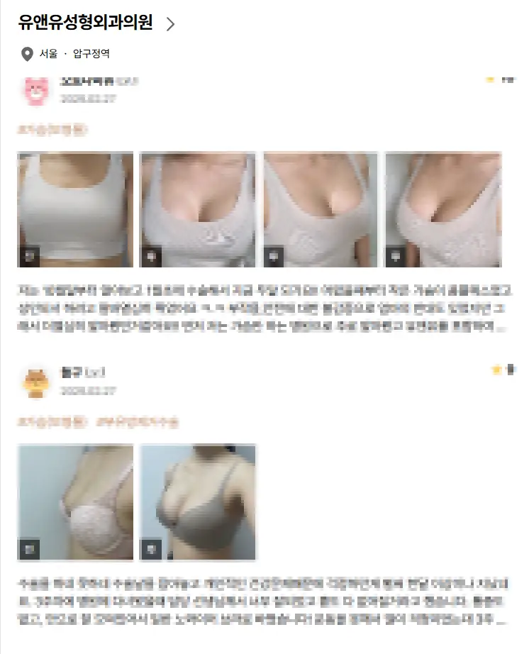 Breast Lift Surgery Cost? Why Looking Up the Price First Is Meaningless. — article image 5