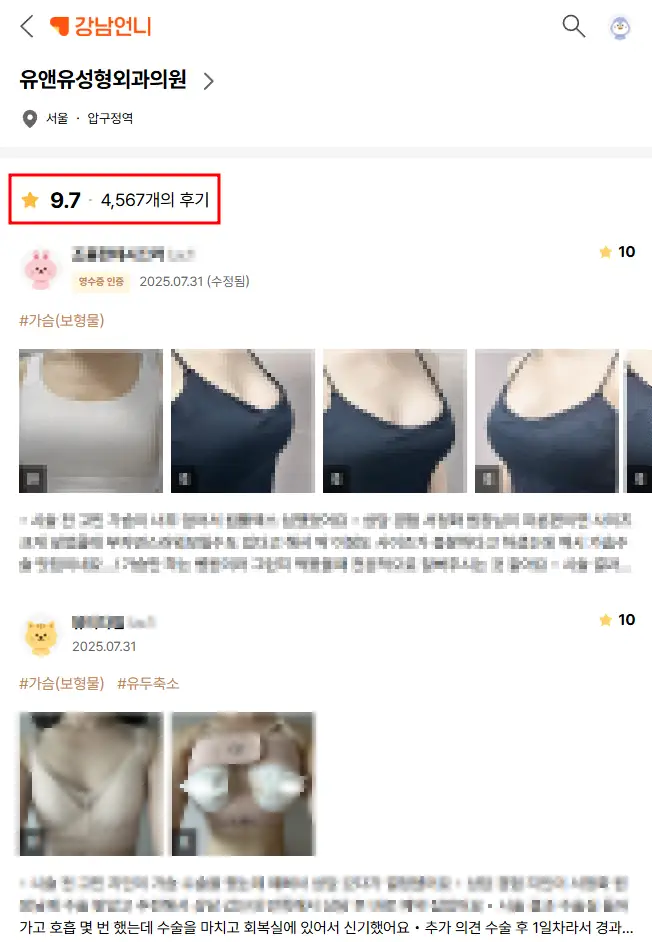 Types of Breast Augmentation — Fat Grafting / Stem Cells / Implants? Which Should You Choose <Advice from 20 Years of Research Experience> — article image 2