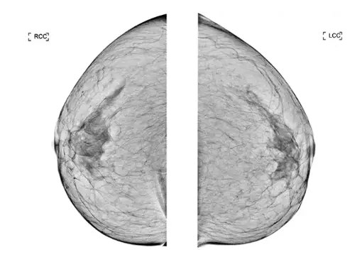 Apgujeong Breast Surgery Clinics: The Misconception That the Surgeon's Reviews Are All You Need — 본문 이미지