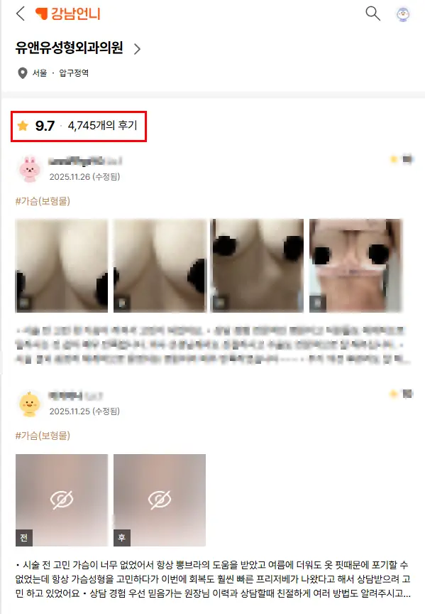 Breast Augmentation Cost? Don't Be Misled — Advice from a Clinic That Performed 3023 Implant Surgeries Last Year — 본문 이미지