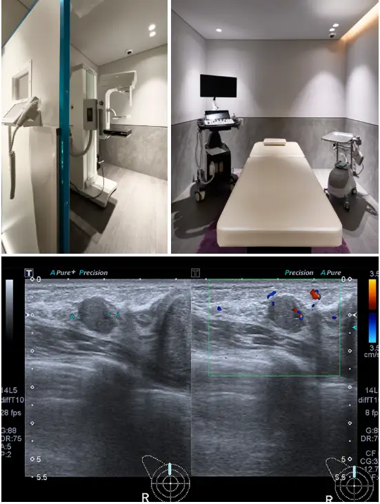 Breast Surgery and Breastfeeding? A Complete Guide by Procedure — Augmentation, Reduction, and Lift <Advice from a Clinic with a Board-Certified Breast Surgeon> — article image 3