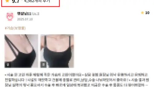 Breast Implant Removal? Pain, Recovery Time, and Body Changes — Summarized from Research — article image 14