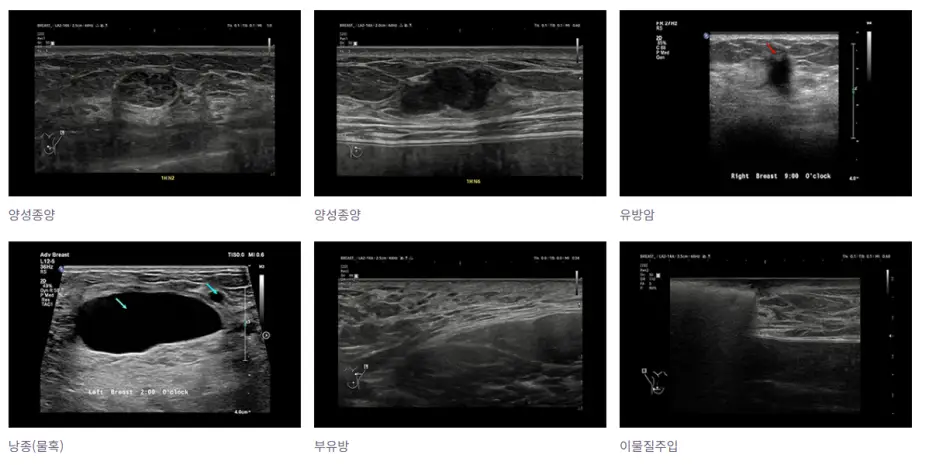 A Gangnam Breast Surgery Clinic? 2 Traits to Look For, Recommended by a Clinic That Performed Over 3000 Surgeries Last Year — 본문 이미지