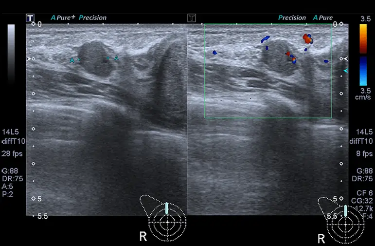 Apgujeong Breast Surgery Clinics: The Misconception That the Surgeon's Reviews Are All You Need — 본문 이미지