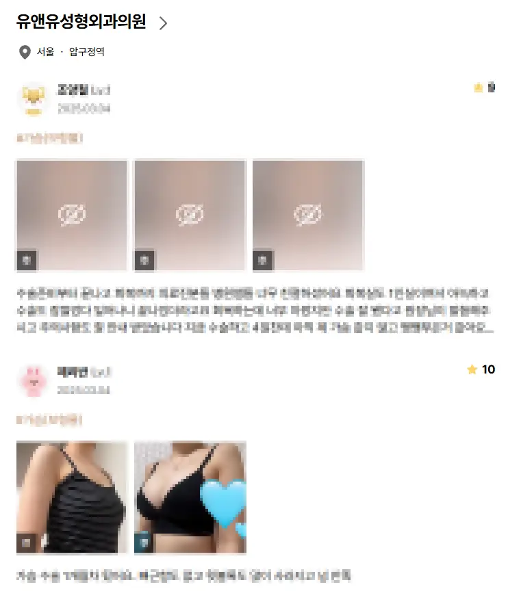 Breast Lift Surgery Cost? Why Looking Up the Price First Is Meaningless. — article image 6