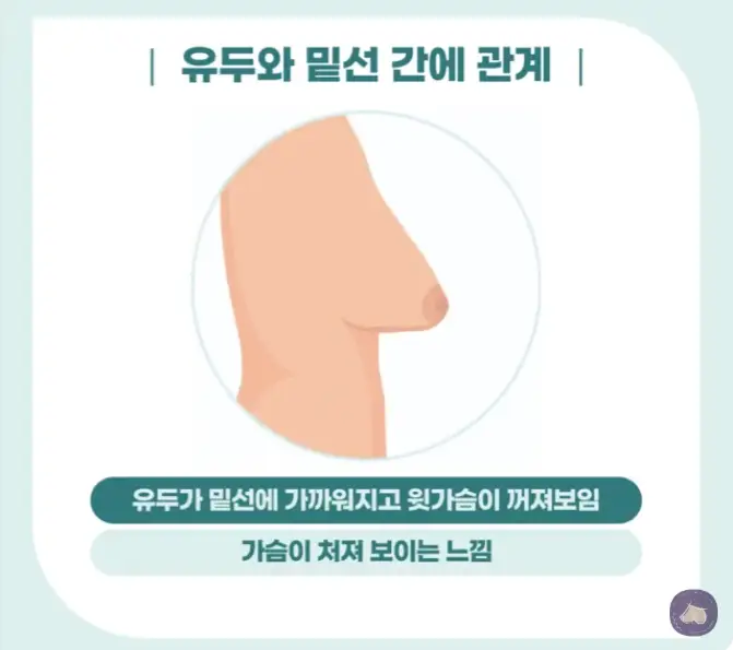 Sagging Breast Surgery Cost? Don't Be Fooled by Reviews. — article image 4