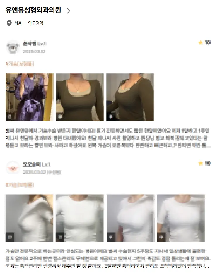 Breast Lift Surgery Cost? Why Looking Up the Price First Is Meaningless. — article image 7