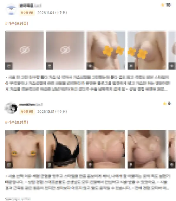 Apgujeong Breast Surgery Clinics: The Misconception That the Surgeon's Reviews Are All You Need — 본문 이미지
