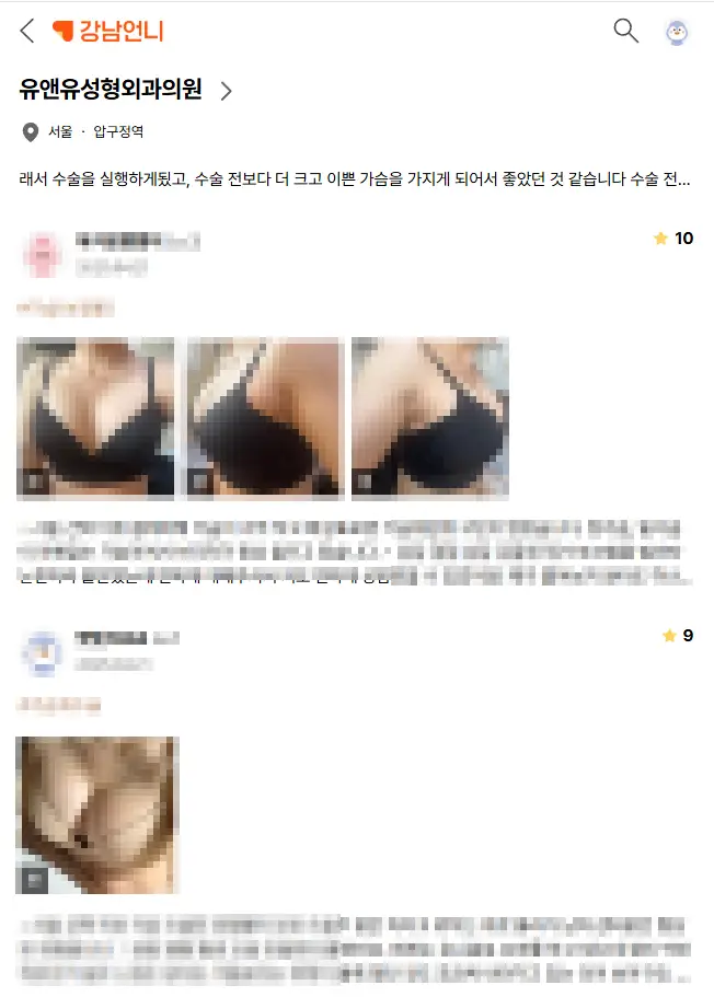 Sagging After Breast Surgery — With Implants In, Won't It Get Even Worse? — article image 2