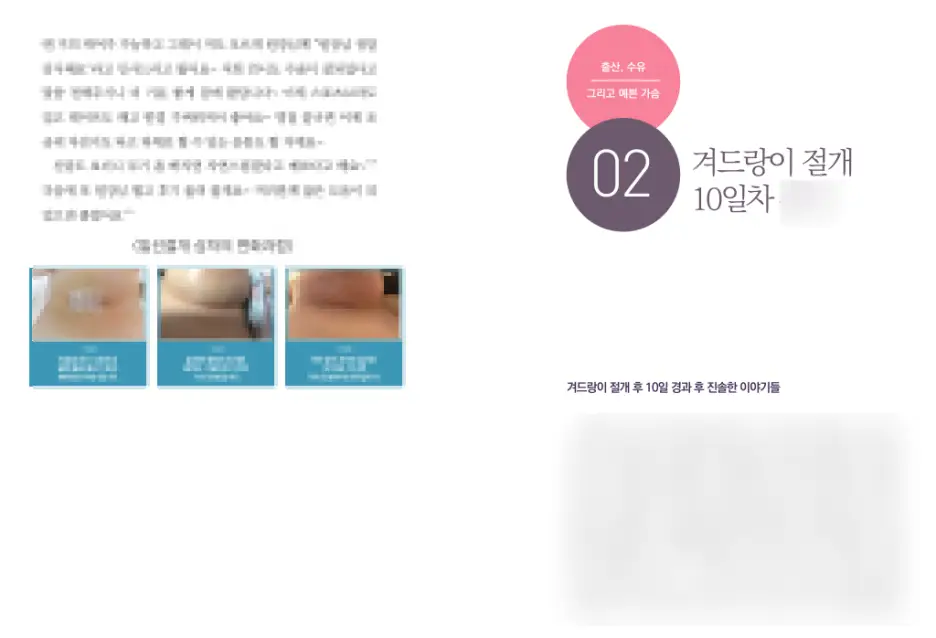 Sagging Breast Surgery Reviews? Don't Be Fooled. — article image 6