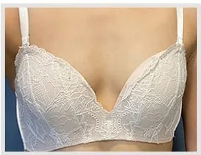 Before breast surgery, photo 4
