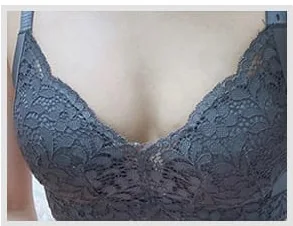 Before breast surgery, photo 5