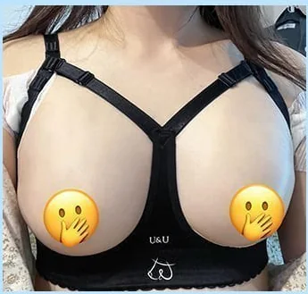 Day 2 after breast surgery, front photo in the compression bra 1