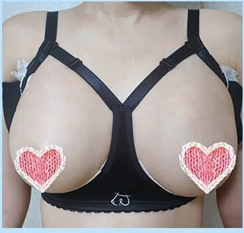 Day 2 after breast surgery, front photo in the compression bra 3