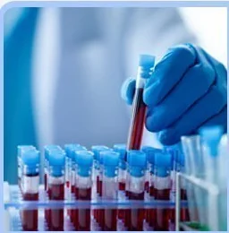 Handling collected blood samples