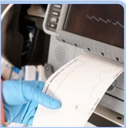 Reviewing an ECG printout