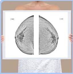 Holding up a mammography film
