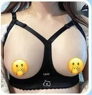 Right after breast surgery, wearing only the compression bra