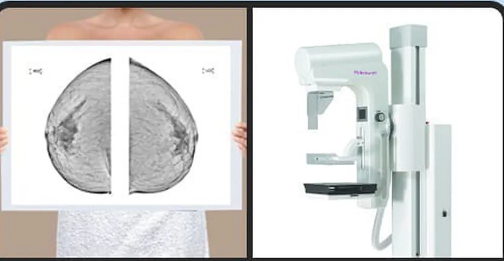 Mammography reading image and mammography equipment