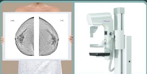 Mammogram films and a mammography unit