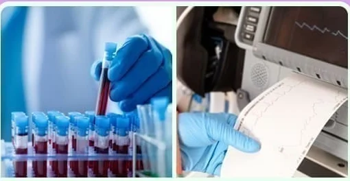 Blood sample collection and an ECG printout