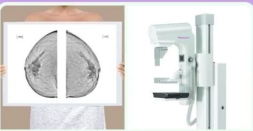 Mammogram films and a mammography unit