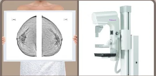 Mammogram films and a mammography unit