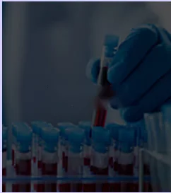 Collected blood samples