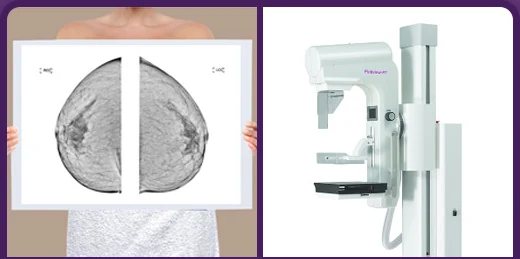 Mammography reading image and mammography equipment