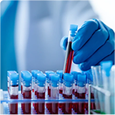 Blood test samples