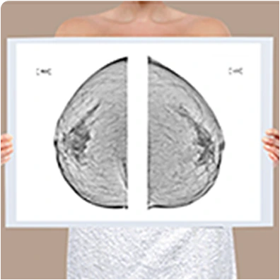 Chest X-ray reading