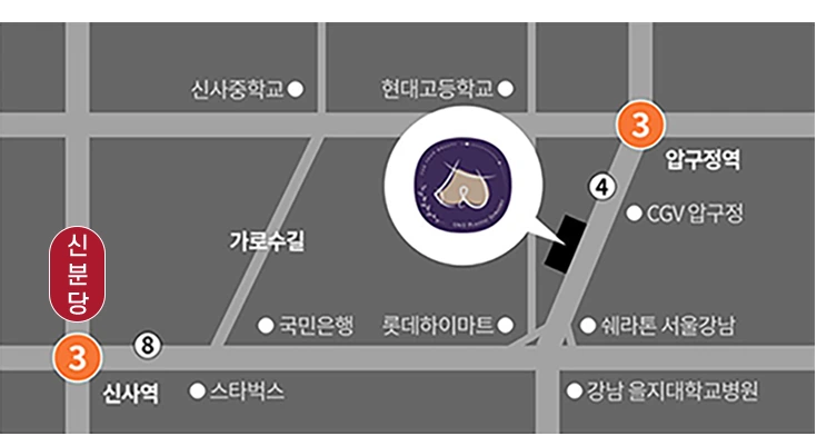 Map to U&U Plastic Surgery: near exit 4 of Apgujeong Station (Line 3), Sinsa Station and Garosu-gil