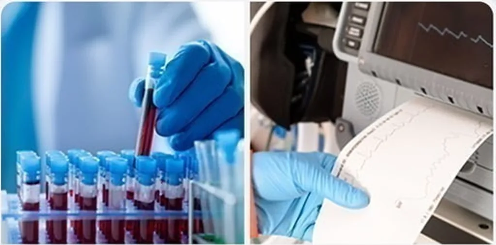 Blood sample collection and an ECG printout