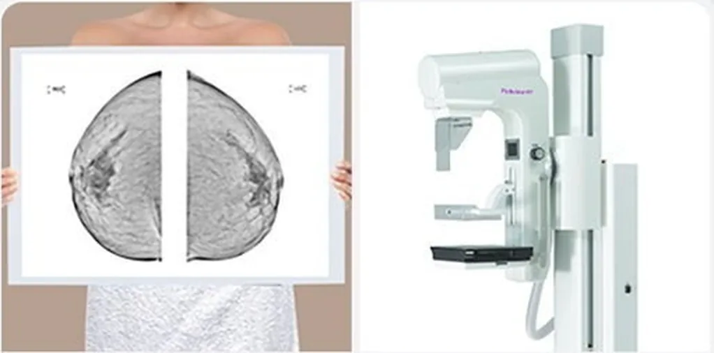 Mammogram films and a mammography unit