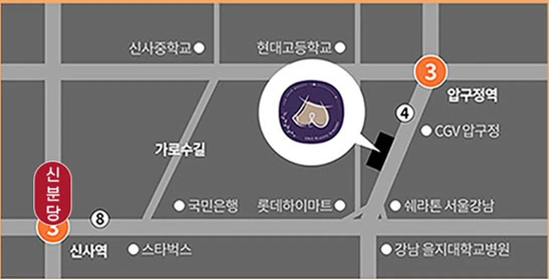 Map to U&U Plastic Surgery Clinic — near Garosu-gil, between Apgujeong Stn (Line 3) and Sinsa Stn (Sinbundang Line)