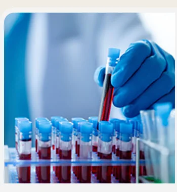Blood sample testing