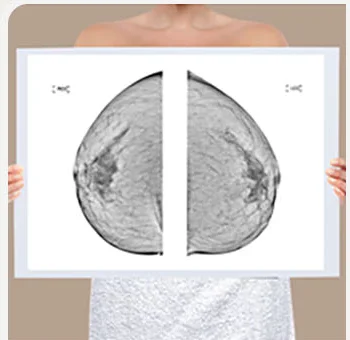 Mammography reading image