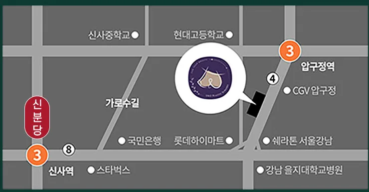 Map to U&U Plastic Surgery Clinic — a 5-minute walk from Apgujeong Station Exit 4, near Garosu-gil