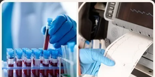 Blood sample collection and an ECG printout