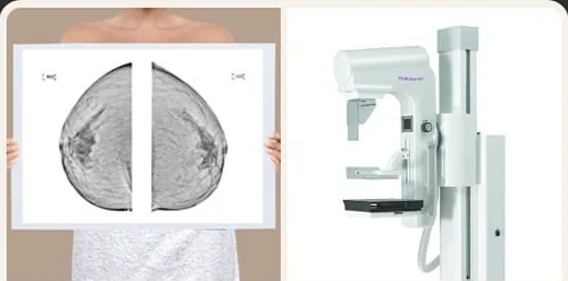 Mammogram films and a mammography unit