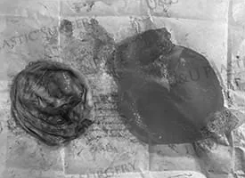 The removed capsule tissue spread out
