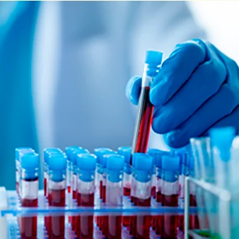 Blood collection tubes for a blood test