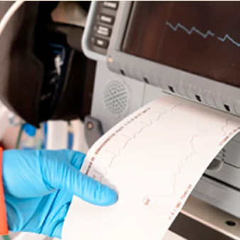 ECG recording strip